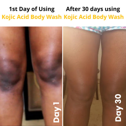 Kojic Acid Turmeric Vita Brightening Body Wash